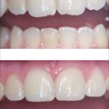 Wanting to fix your wonky smile? Consider a cosmetic re-contour!