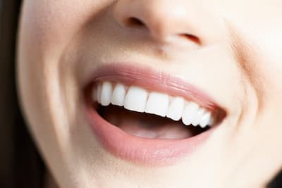 Woman smiling with white